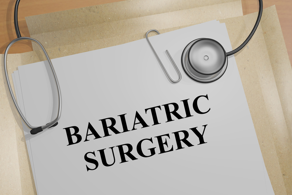 Top Corrective Bariatric Surgeon