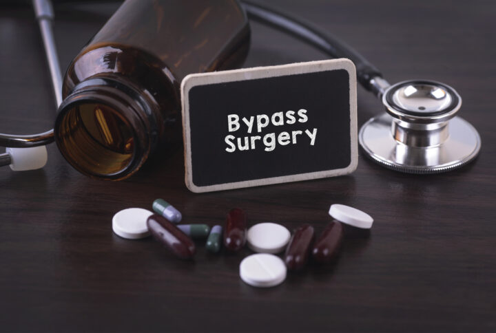 Best Gastric Bypass Surgery Revision Specialist